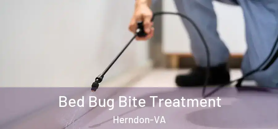  Bed Bug Bite Treatment Herndon-VA